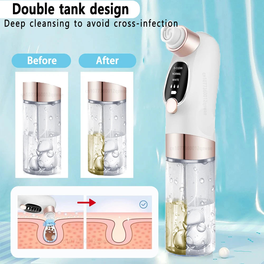 Blackhead Remover Pore Vacuum Face Cleaner Electric Pimple Acne Black Head Removal