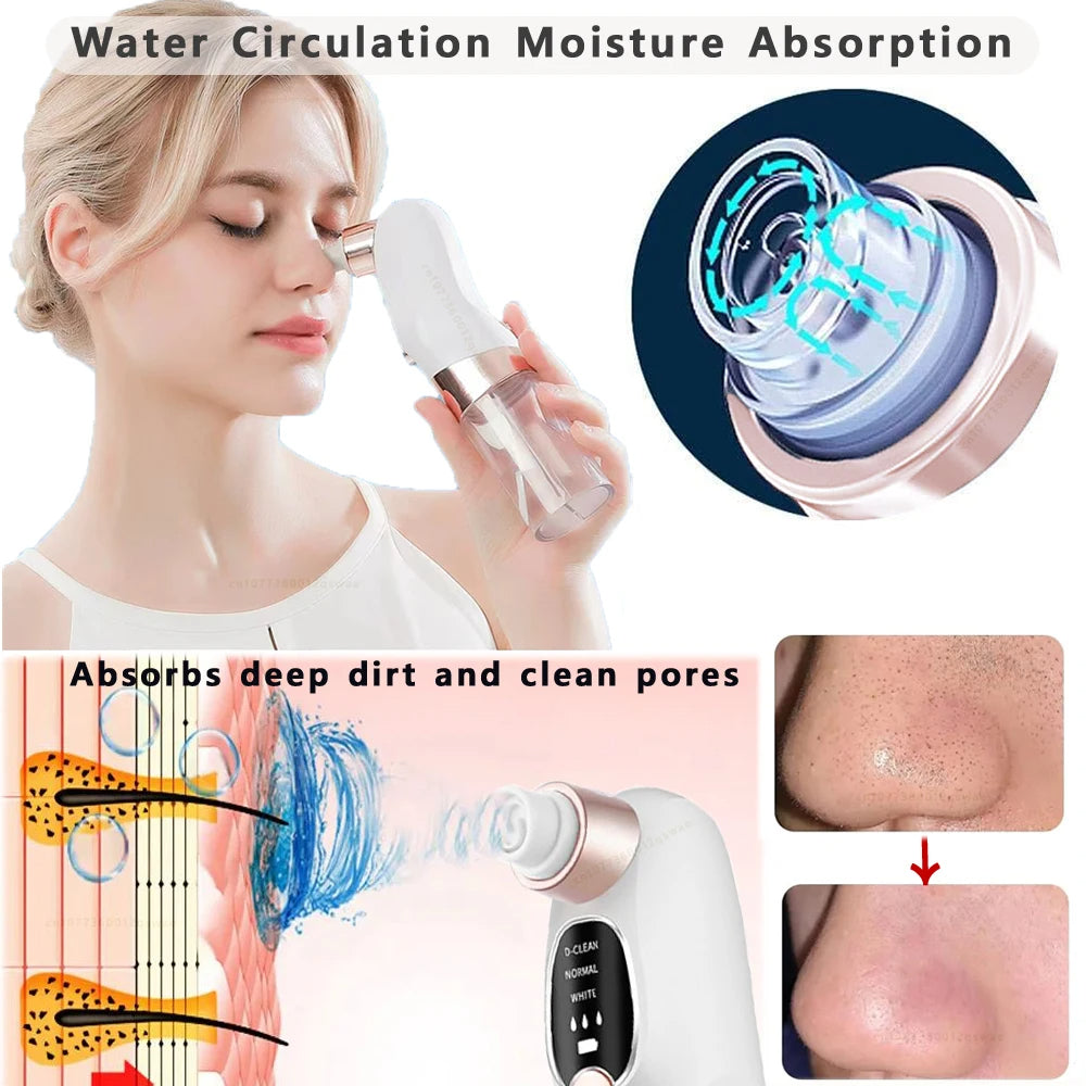 Blackhead Remover Pore Vacuum Face Cleaner Electric Pimple Acne Black Head Removal